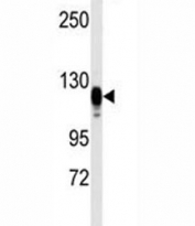 Western blot analysis of EGF Receptor antibody and kidney heart tissue lysate