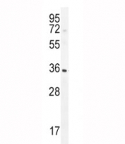 IGFBP3 antibody western blot analysis in CHO tissue lysate. The glycoprotein is visualized between 31~44 kDa.