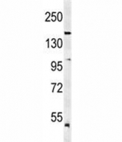 Western blot analysis of KDR antibody and mouse lung tissue lysate. Predicted molecular weight: ~152 (immature), 180-200 kDa (intermediate) and 220-230 kDa (mature).