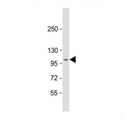 Western blot testing of human MCF7 cell lysate with DDR1 antibody. Predicted molecular weight: 100-125 kDa.