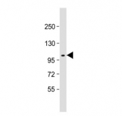 Western blot testing of rat brain tissue lysate with DDR1 antibody. Predicted molecular weight: 100-125 kDa.