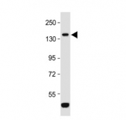 Western blot testing of mouse NIH 3T3 cell lysate with ROR1 antibody. Predicted molecular weight of ROR1 isoforms: 105 kDa and 130 kDa.