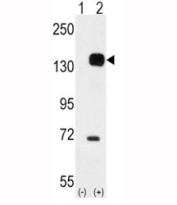 Western blot analysis of TIE2 antibody and 293 cell lysate either nontransfected (Lane 1) or transiently transfected with the TEK gene (2).