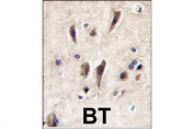 IHC analysis of FFPE human brain tissue stained with TIE1 antibody.