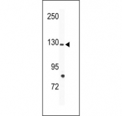 Western blot analysis of TIE1 antibody and mouse bladder tissue lysate.
