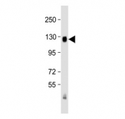 Western blot analysis of TrkA antibody and mouse brain lysate. Observed molecular weight: 85~140 kDa depending on glycosylation level.