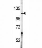 Western blot analysis of c-Abl antibody and A2058 lysate. Predicted molecular weight ~120-150 kDa.