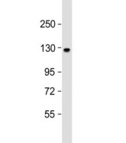 Western blot testing of human brain lysate with ACK1 antibody at 1:1000. Predicted molecular weight ~114 kDa.