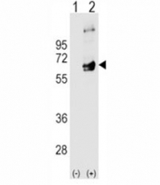 Western blot analysis of FYN antibody and 293 cell lysate (2 ug/lane) either nontransfected (Lane 1) or transiently transfected (2) with the FYN gene.