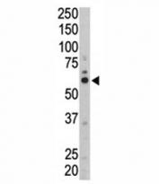 Western blot analysis of FYN antibody and mouse liver tissue lysate. Predicted molecular weight: ~59 kDa.