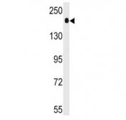 Western blot analysis of ACE antibody and mouse lung tissue lysate. Expected molecular weight 140-170 kDa.