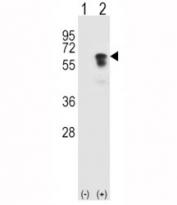 Western blot analysis of ALK2 antibody and 293 cell lysate (2 ug/lane) either nontransfected (Lane 1) or transiently transfected (2) with the ACVR1 gene.
