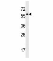 ALK2 antibody western blot analysis in U937 lysate