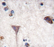 IHC analysis of FFPE human brain tissue stained with B-RAF antibody