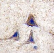 IHC analysis of FFPE human brain tissue stained with BRAF antibody