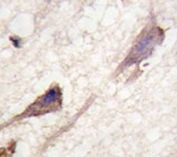 IHC analysis of FFPE human brain tissue stained with BRAF antibody