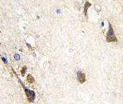 IHC analysis of FFPE human brain tissue stained with Acetylcholinesterase antibody