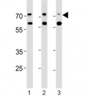 Acetylcholinesterase antibody western blot analysis in human 1) Jurkat, 2) Raji and 3) Y79 lysate. Predicted molecular weight ~68 kDa with a possible ~58 kDa isoform.