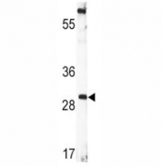 Western blot analysis of BDNF antibody and human CEM lysate. Predicted molecular weight ~28 kDa.