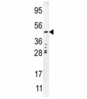 Western blot analysis of UPA antibody and CEM lysate