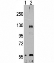 Western blot analysis of TRPM8 antibody and 293 cell lysate either nontransfected (Lane 1) or transiently transfected with the TRPM8 gene (2).