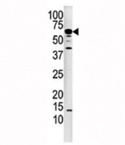 Western blot analysis of Calcineurin antibody and mouse kidney tissue lysate. Predicted molecular weight: ~62 kDa.