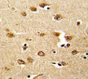 IHC analysis of FFPE human brain tissue stained with ABI1 antibody