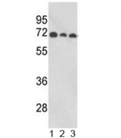 Western blot analysis of ABI1 antibody and human 1) MCF-7, 2) CEM, and 3) Jurkat lysate. Predicted molecular weight ~55 kDa, commonly observed at 55-65 kDa.