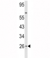 Western blot analysis of IFNB1 antibody and HepG2 lysate.