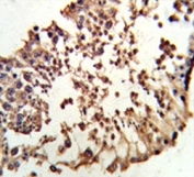 IHC analysis of FFPE human testis tissue stained with Retinoblastoma antibody
