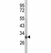Western blot analysis of Olig3 antibody and mouse spleen tissue lysate