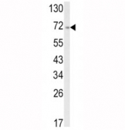 Western blot analysis of ATF6 antibody and A2058 lysate. Predicted molecular weight: 75~90kDa.