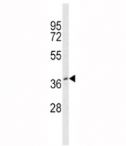 Western blot analysis of BMI1 antibody and MCF7 lysate. Predicted molecular weight: 37-43 kDa.