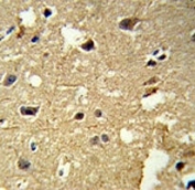 IHC analysis of FFPE human brain tissue stained with anti-beta Tubulin antibody