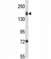 Western blot analysis of Integrin alpha 2 antibody and MDA-MB231 lysate