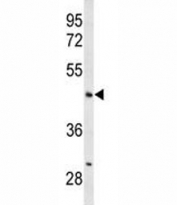 Western blot analysis of ANGPTL4 antibody and mouse liver tissue lysate. Predicted molecular weight: ~45 kDa and ~41 kDa, but may be observed at higher molecular weights due to glycosylation.