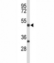 Western blot analysis of MEF2A antibody and mouse brain tissue lysate