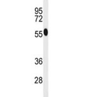 Western blot analysis of ACSM1 antibody and human K562 lysate. Predicted molecular weight ~65 kDa.