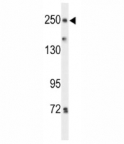 Western blot analysis of PTPRD antibody and HeLa lysate.
