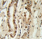 FOXP1 antibody IHC analysis in formalin fixed and paraffin embedded lung tissue.