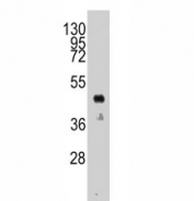 Western blot analysis of anti-HA antibody testing a 12-tag recombinant protein.