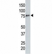 Anti-HA tag antibody testing a tagged recombinant protein.