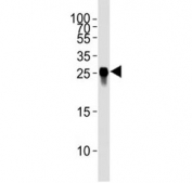 Western blot analysis of tagged protein lysate using GFP antibody at 1:4000.