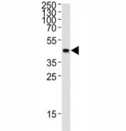 Western blot analysis of lysate from 12 tag recombinant protein (41 kDa) using GST Tag antibody at 1:1000.