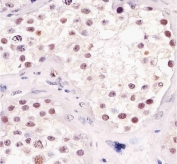 Immunohistochemical analysis of paraffin-embedded human testis using TBP antibody at 1:25 dilution.