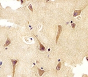 Immunohistochemical analysis of paraffin-embedded human brain using UCHL1 antibody at 1:25 dilution.