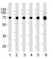 Acetylcholinesterase antibody western blot analysis in 1) human Raji, 2) human Jurkat, 3) human COS7, 4) mouse NIH3T3, 5) mouse cerebellum, and 6) rat cerebellum lysate. Predicted molecular weight ~68 kDa.