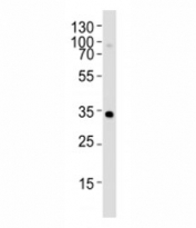 Western blot analysis of lysate from Y79 cell line using OTX2 Anitbody at 1:1000.
