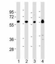 Western blot testing of Lyn antibody at 1:2000 dilution and mouse samples: Lane 1: kidney lysate; 2: heart lysate; 3: ovary lysate; 4: skeletal muscle lysate; Predicted molecular weight 56/58 kDa (isoforms 1/2).
