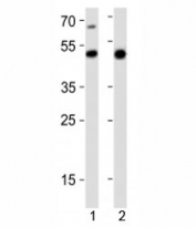 Western blot analysis of lysate from 1) mouse heart and 2) rat stomach tissue lysate using Gata6 antibody at 1:1000. Predicted molecular weight: 60, 45 kDa (isoforms 1, 2).